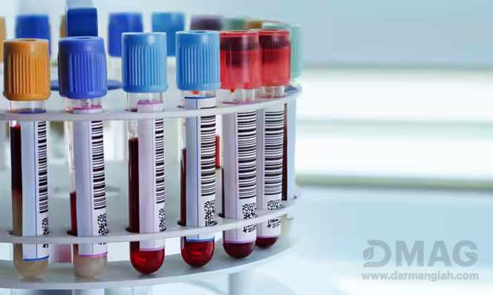 جدول تفسیر آزمایش خون 
