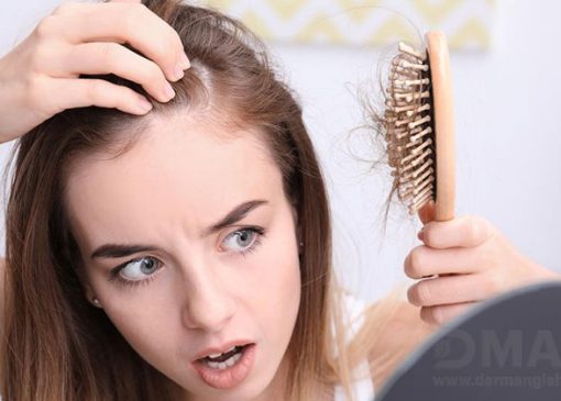 قرص پرفکتیل اورجینال برای ریزش مو خوب است؟