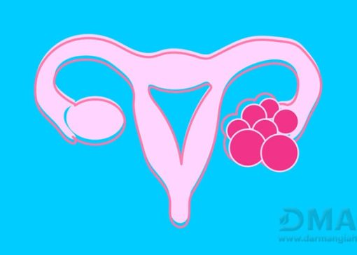 سیر برای عفونت واژن | شیاف سیر