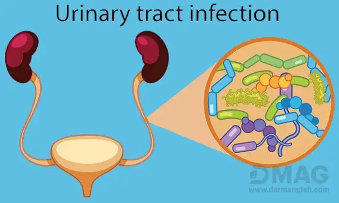 درمان قطعی عفونت ادراری