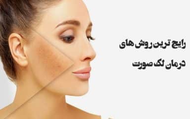 درمان لکه صورت - درمانگیاه